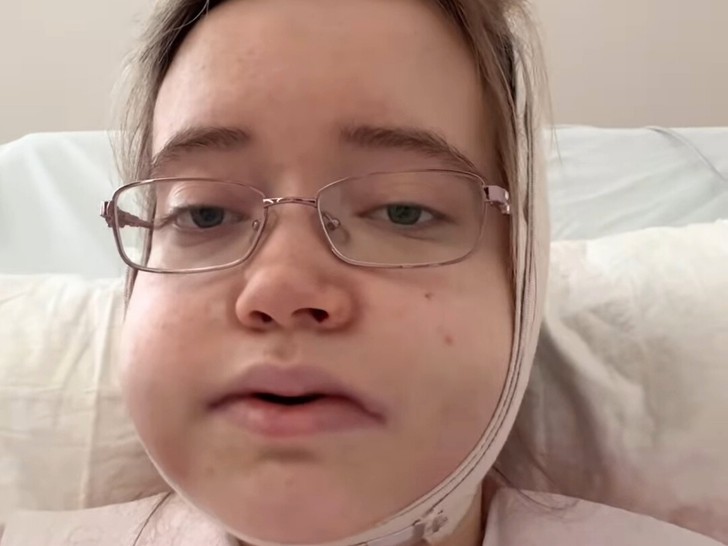 Piosenkarka podróżuje 24 godziny na operację szczęki, dzieli się szokującą przemianą!