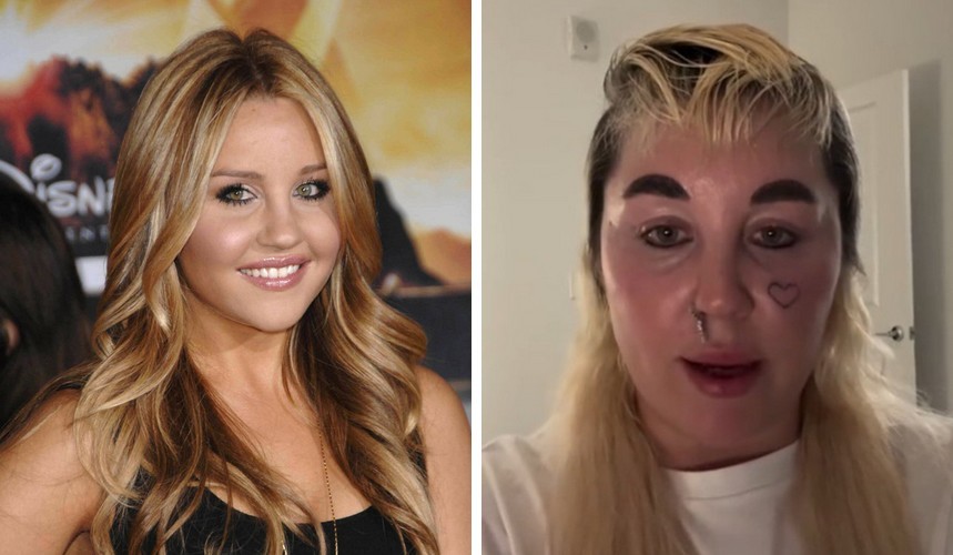 Drastyczna zmiana wyglądu Amandy Bynes niepokoi fanów!