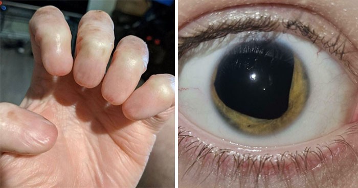 30 fascynujących i szalonych rzeczy, które mogą przydarzyć się ludzkiemu ciału!