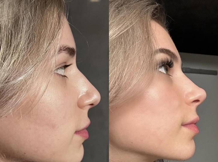 13 oszałamiających transformacji, które celebrują kobiecą siłę!