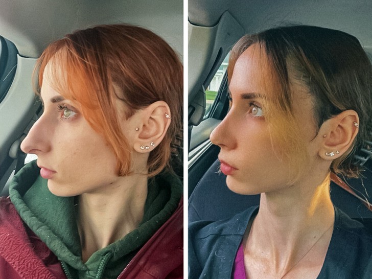 13 zdjęć „przed” i „po”, które opowiadają całą historię!