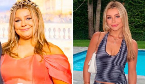 30 osób, które nie są już takie same jak kiedyś, dzielą się zdjęciami porównawczymi!