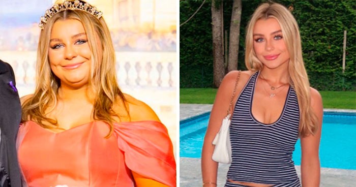 30 osób, które nie są już takie same jak kiedyś, dzielą się zdjęciami porównawczymi!