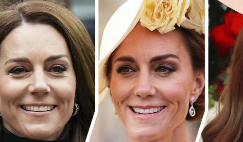 Zmieniająca się twarz księżnej Kate wywołuje burzliwe spekulacje!