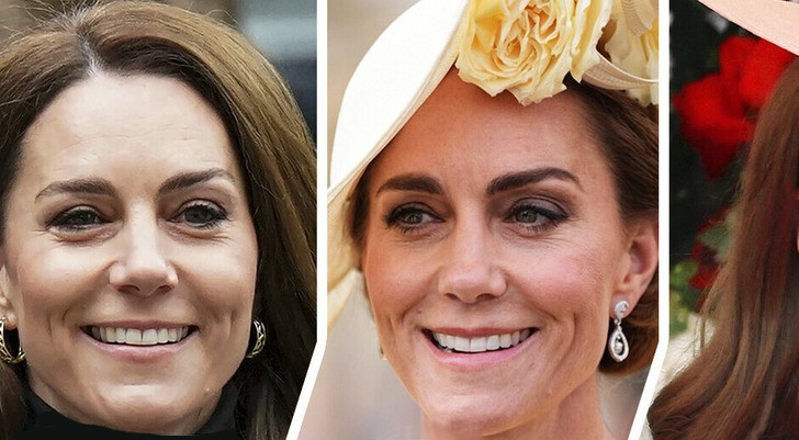 Zmieniająca się twarz księżnej Kate wywołuje burzliwe spekulacje!
