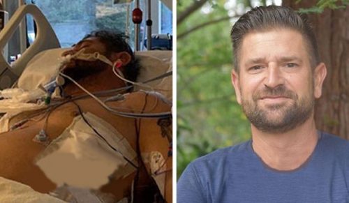 30 zdjęć „przed i po” ujawniających inspirujące historie o zmieniających życie wyzdrowieniach!