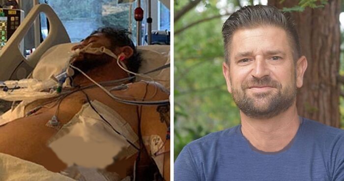 30 zdjęć „przed i po” ujawniających inspirujące historie o zmieniających życie wyzdrowieniach!