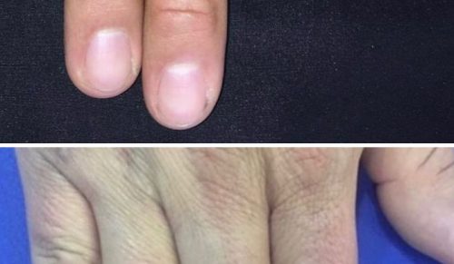 35 razy klienci poprosili tatuatorów o zakrycie blizn i pieprzyków – i nie mogli być bardziej zachwyceni