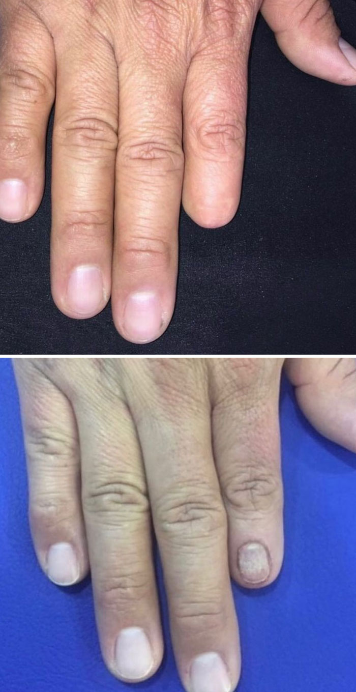 35 razy klienci poprosili tatuatorów o zakrycie blizn i pieprzyków – i nie mogli być bardziej zachwyceni