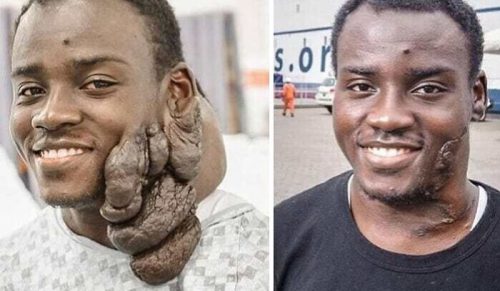 30 medycznych zdjęć równie fascynujących, co niepokojących