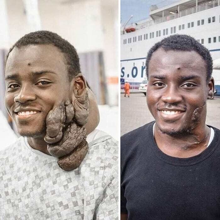 30 medycznych zdjęć równie fascynujących, co niepokojących