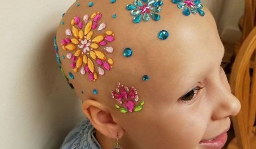 25 osób z chorobami i niepełnosprawnościami, które rozbrajają trudności humorem