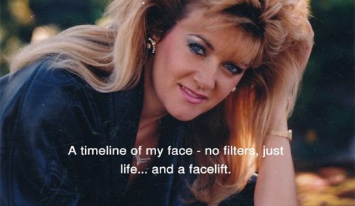 Kobieta pokazuje, jak się starzeje — i jak wygląda po liftingu w wieku 70 lat