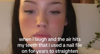 57 szalonych rzeczy, które nastolatki robiły, by sprostać kanonom piękna