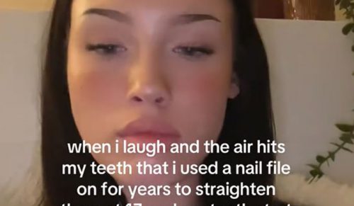 57 szalonych rzeczy, które nastolatki robiły, by sprostać kanonom piękna