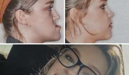 26 niezwykłych przypadków medycznych, które pokażą, jak zdumiewające jest ludzkie ciało