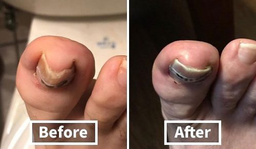 Kasa Samoobsługowa to Za Mało: 24 Wstydliwe Zakupy, Które Wymagają Prywatności