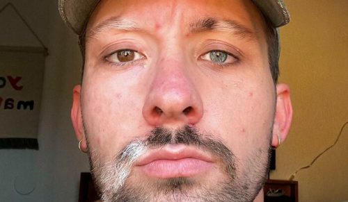 Ludzie dzielą się 44 rzadkimi i niezwykłymi cechami fizycznymi