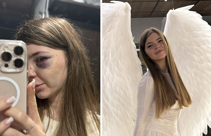 A woman before and after leaving unhappy marriages, with a bruised eye then looking happy with angel wings.