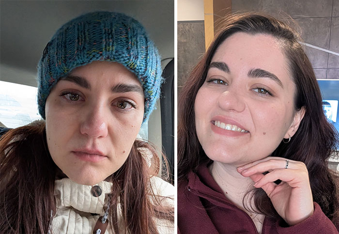 A woman looking completely different after leaving unhappy marriages, smiling brightly in the after photo, revealing a positive change.