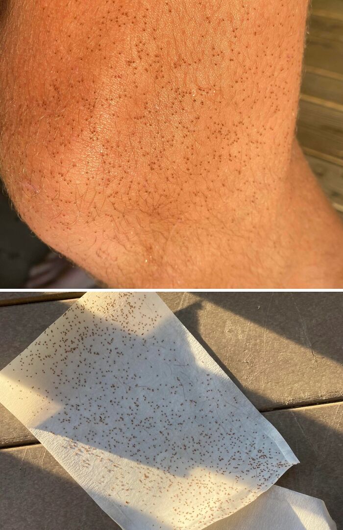 A truly bizarre close-up of a person's arm covered in tiny brown specks, and a paper towel with similar specks.