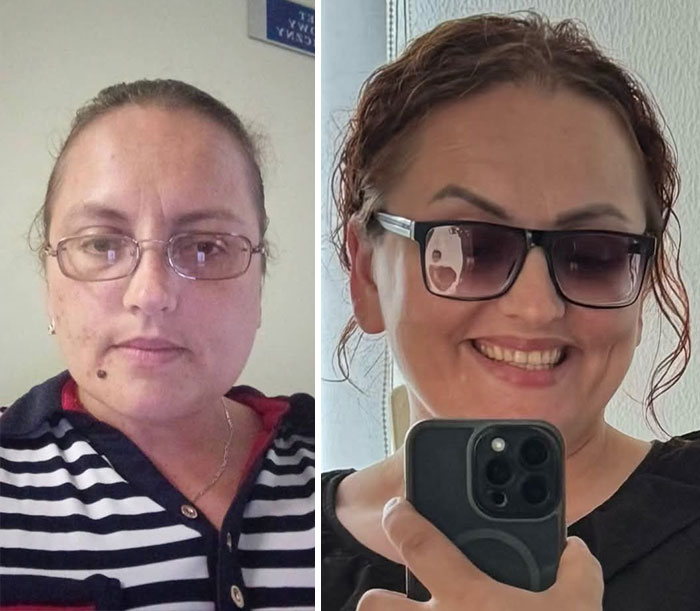 A woman looking completely different after leaving unhappy marriages, smiling in the after photo.