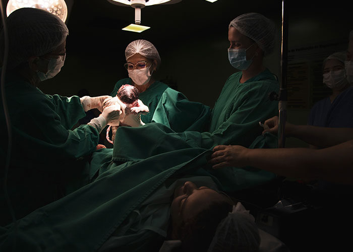 Medical team performing a C-section delivery, depicting the intense experience of giving birth in a hospital setting